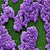 Anthrax Bacteria (Photo Credit: Janice Haney Carr)