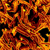 Mycobacterium tuberculosis (Image courtesy NIAID)